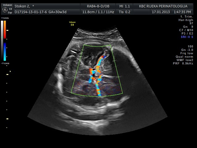 Slika 1. Transverzalni Ultrazvučni Prikaz